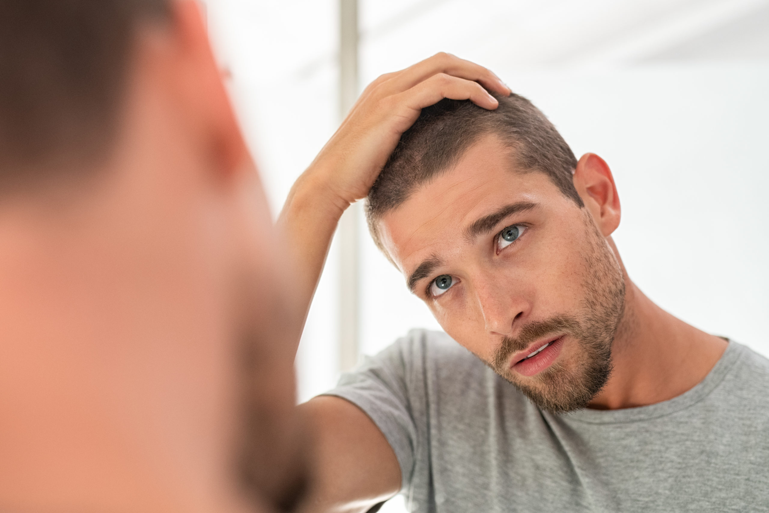 effects of hair loss